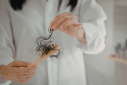 ¿Caída de cabello? Los tratamientos que sí funcionan