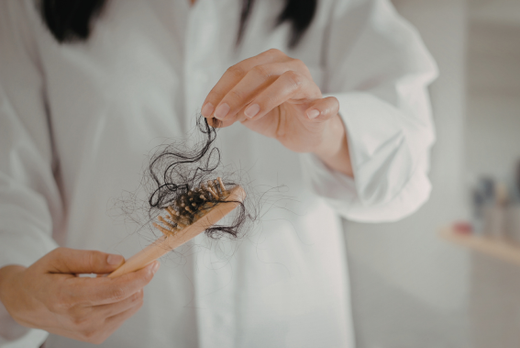 ¿Caída de cabello? Los tratamientos que sí funcionan