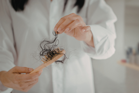 ¿Caída de cabello? Los tratamientos que sí funcionan