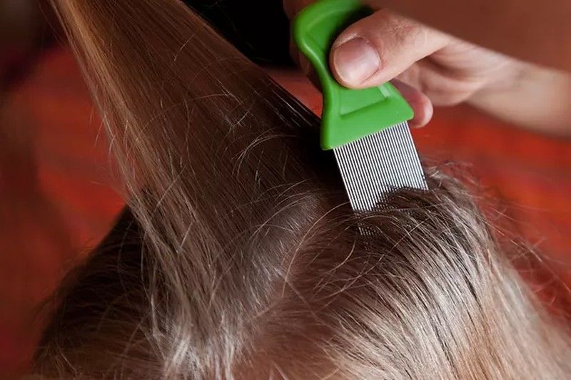 Conoce los tratamientos más efectivos para erradicar a piojos y liendres.