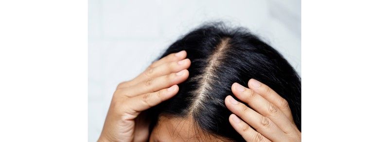 Consejos para prevenir la caída capilar