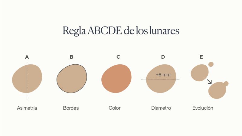 ¿Qué es el cáncer de piel?