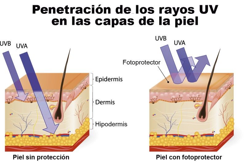 ¿Por qué nos quemamos ?