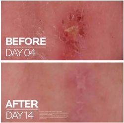La Roche Posay Cicaplast Balsamo B5+ 100ml