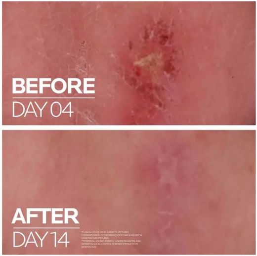 La Roche Posay Cicaplast Balsamo B5+ 100ml